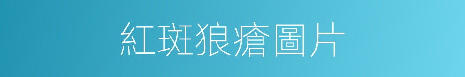 紅斑狼瘡圖片的同義詞