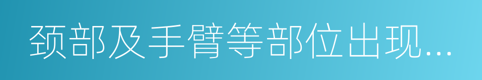 颈部及手臂等部位出现红肿的同义词